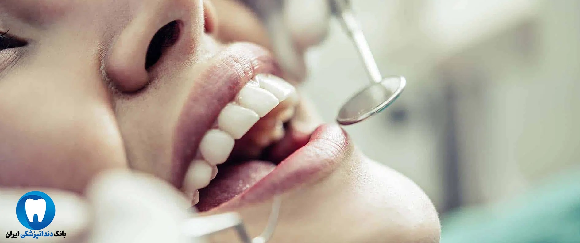 بهترین دندانپزشک زیبایی در قزوین کیست