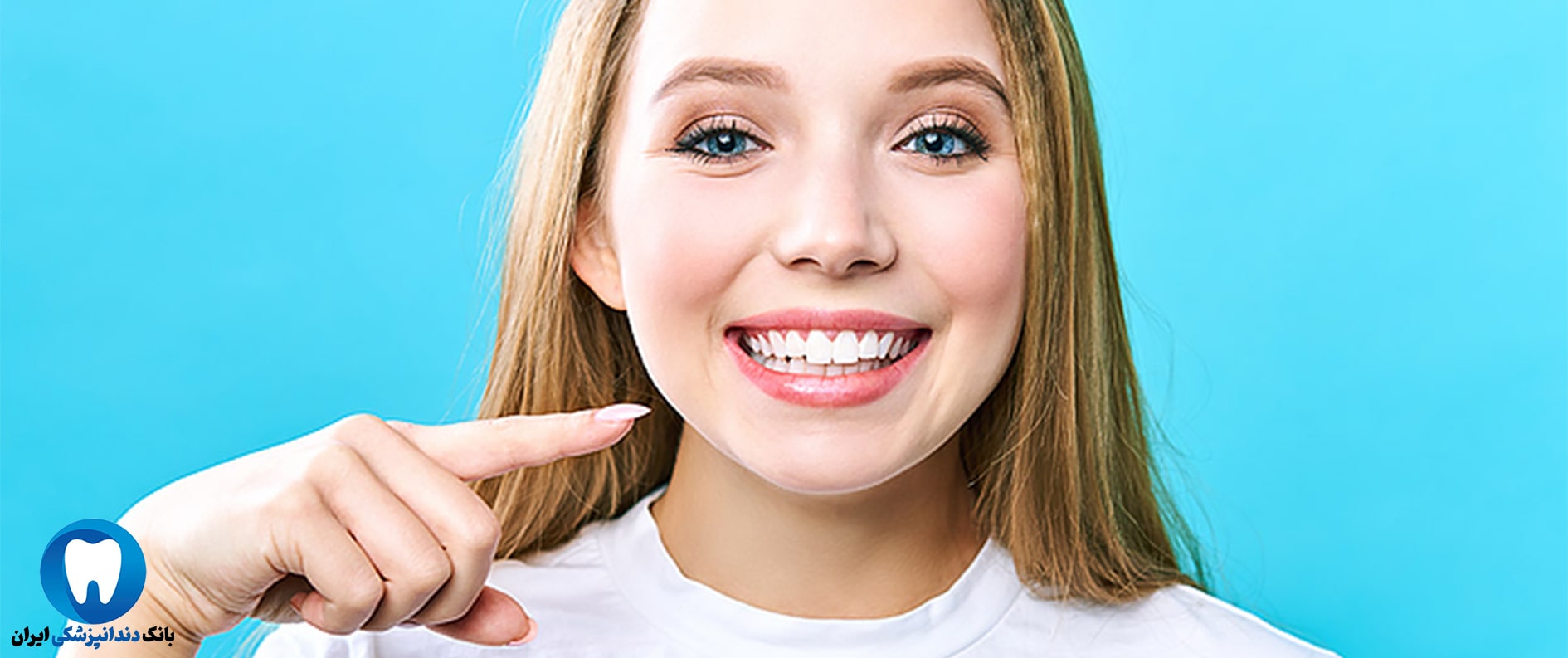 بلیچینگ دندان در بهترین کلینیک تخصصی دندانپزشکی زیبایی در اهواز