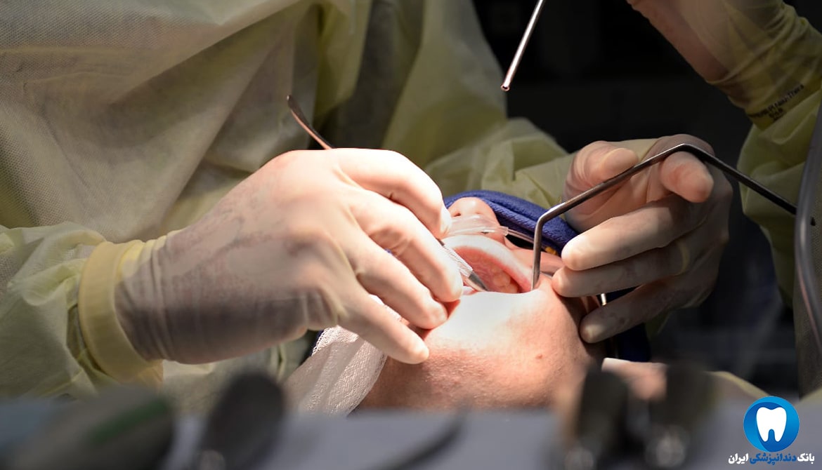 جراحی برای کاشت دندان