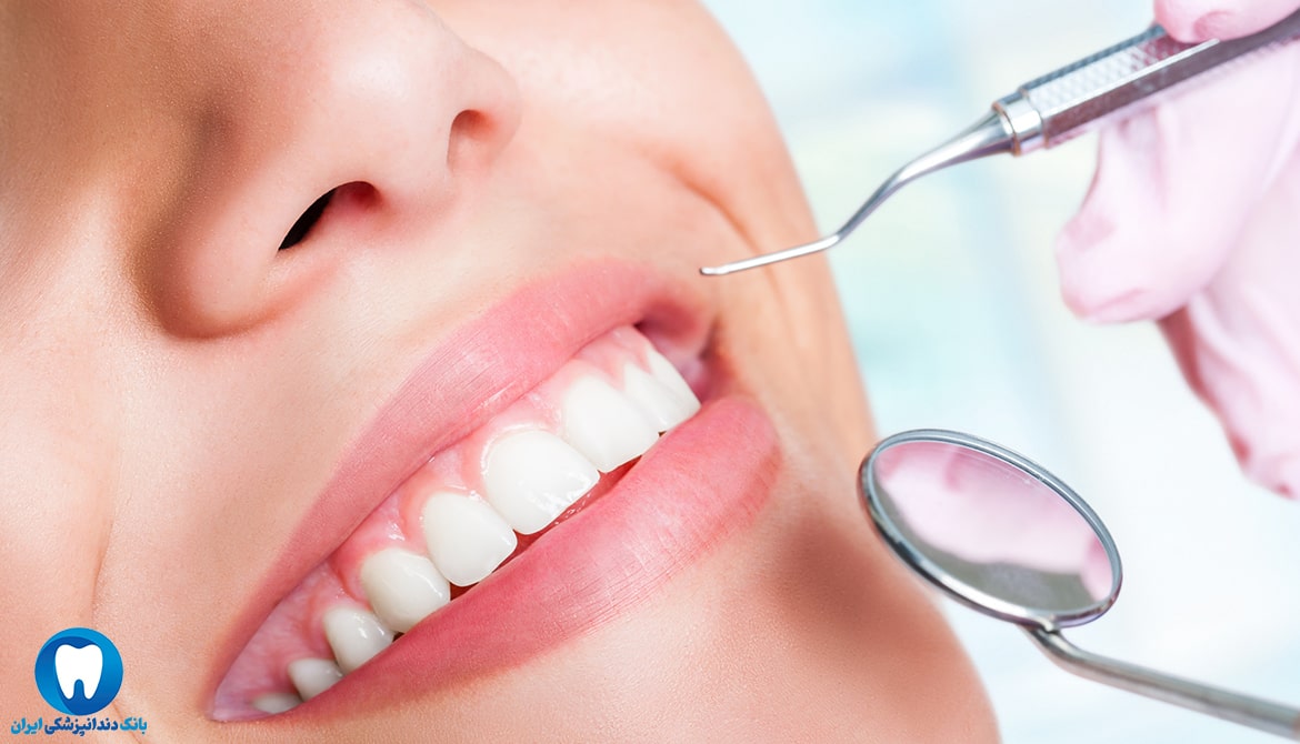 بهترین دکتر دندانپزشکی ایمپلنت دندان در اصفهان کیست