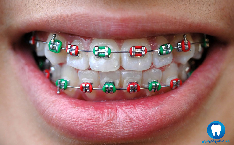بهترین دندانپزشک متخصص ارتودنسی در تبریز