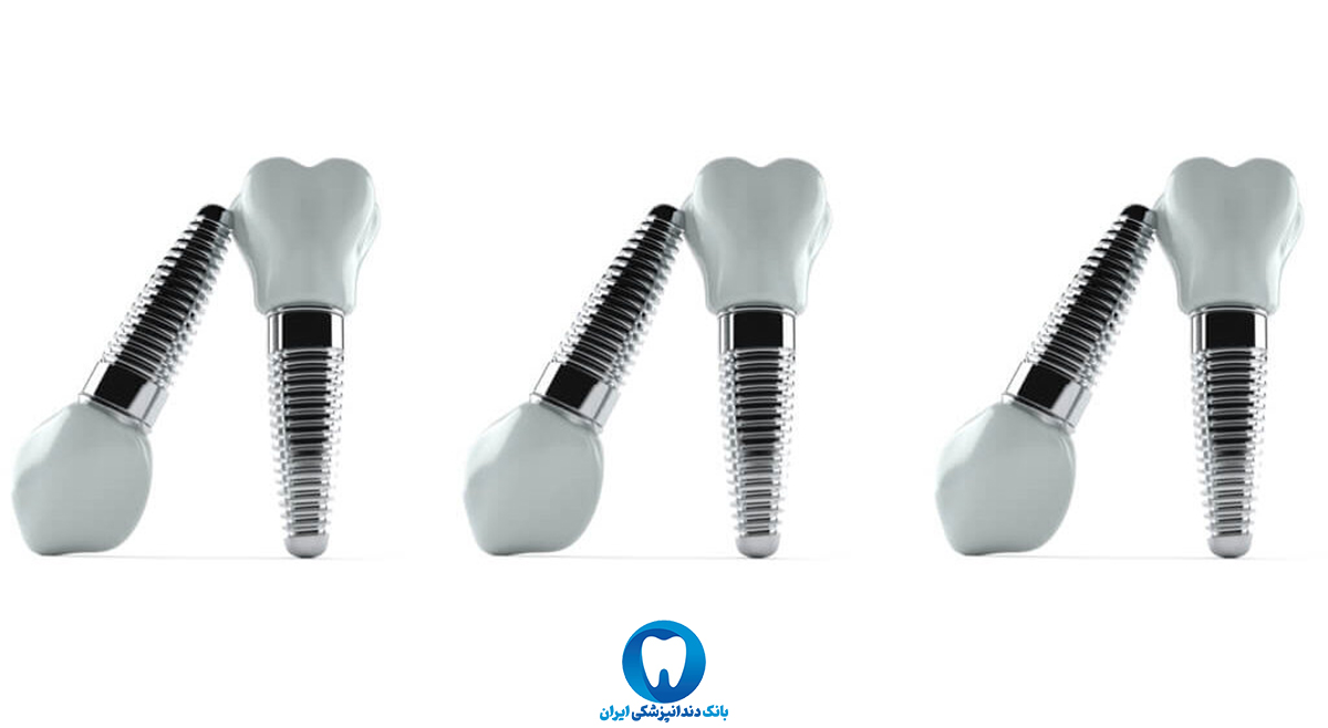 بهترین کلینیک تخصصی دندانپزشکی ایمپلنت دندان در ارومیه