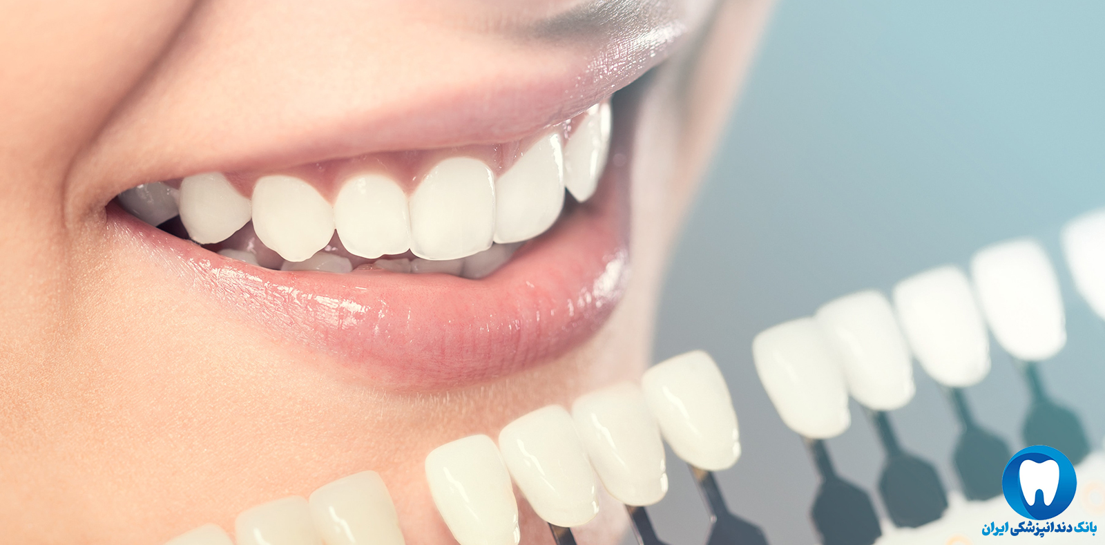 بهترین دکتر برای کامپوزیت دندان در تبریز