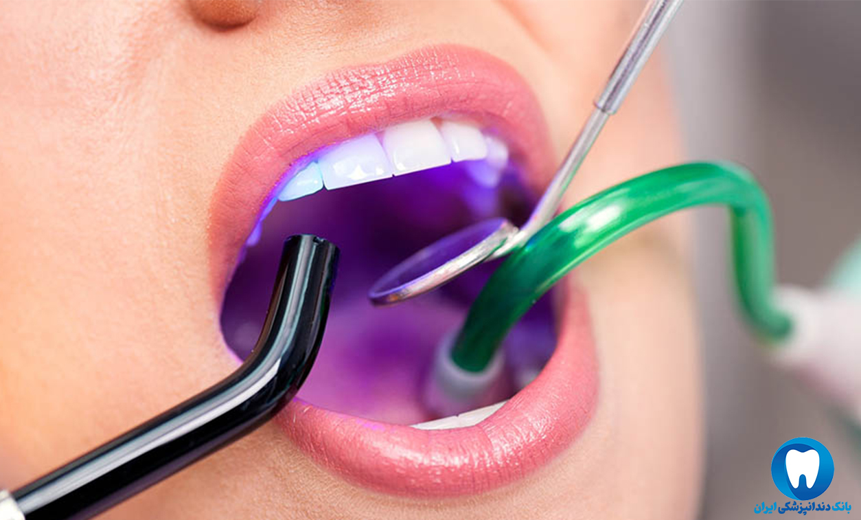 بهترین دندانپزشک کامپوزیت مشهد
