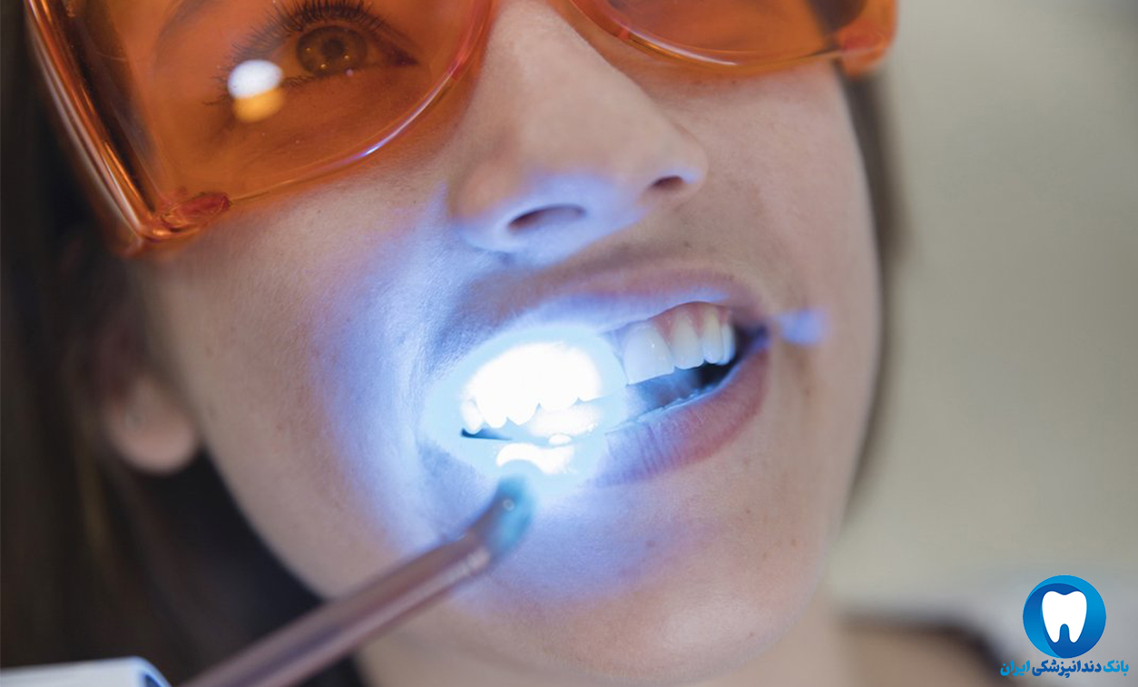 شماره بهترین دندانپزشک کامپوزیت در مشهد