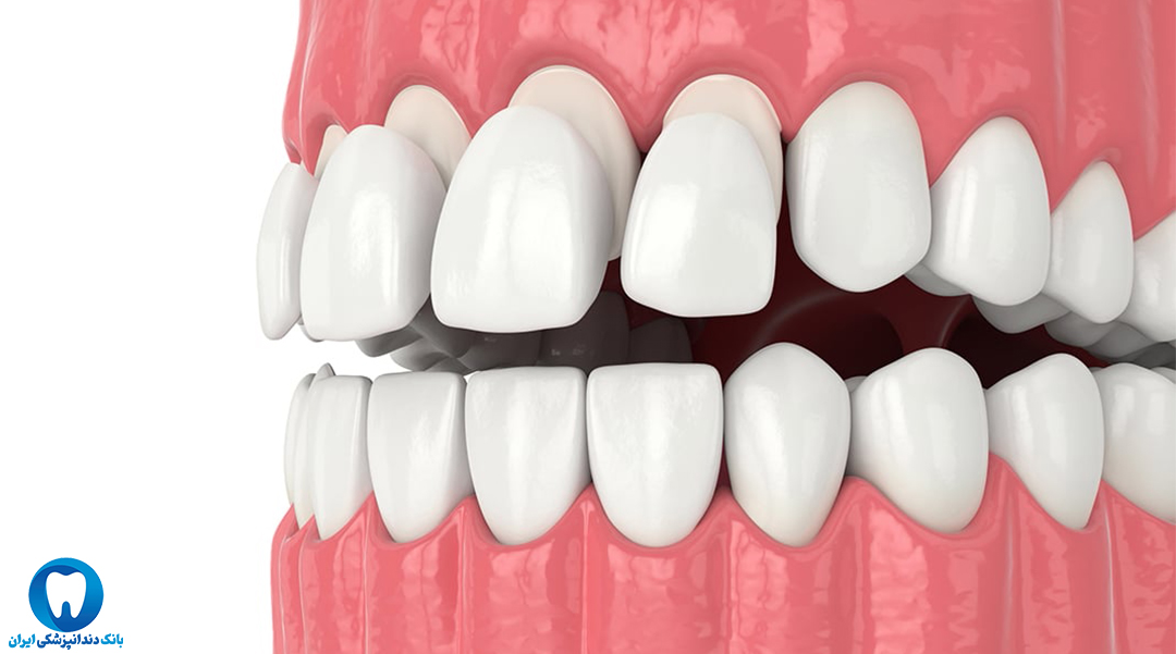 آدرس بهترین دندانپزشک کامپوزیت دندان در اهواز