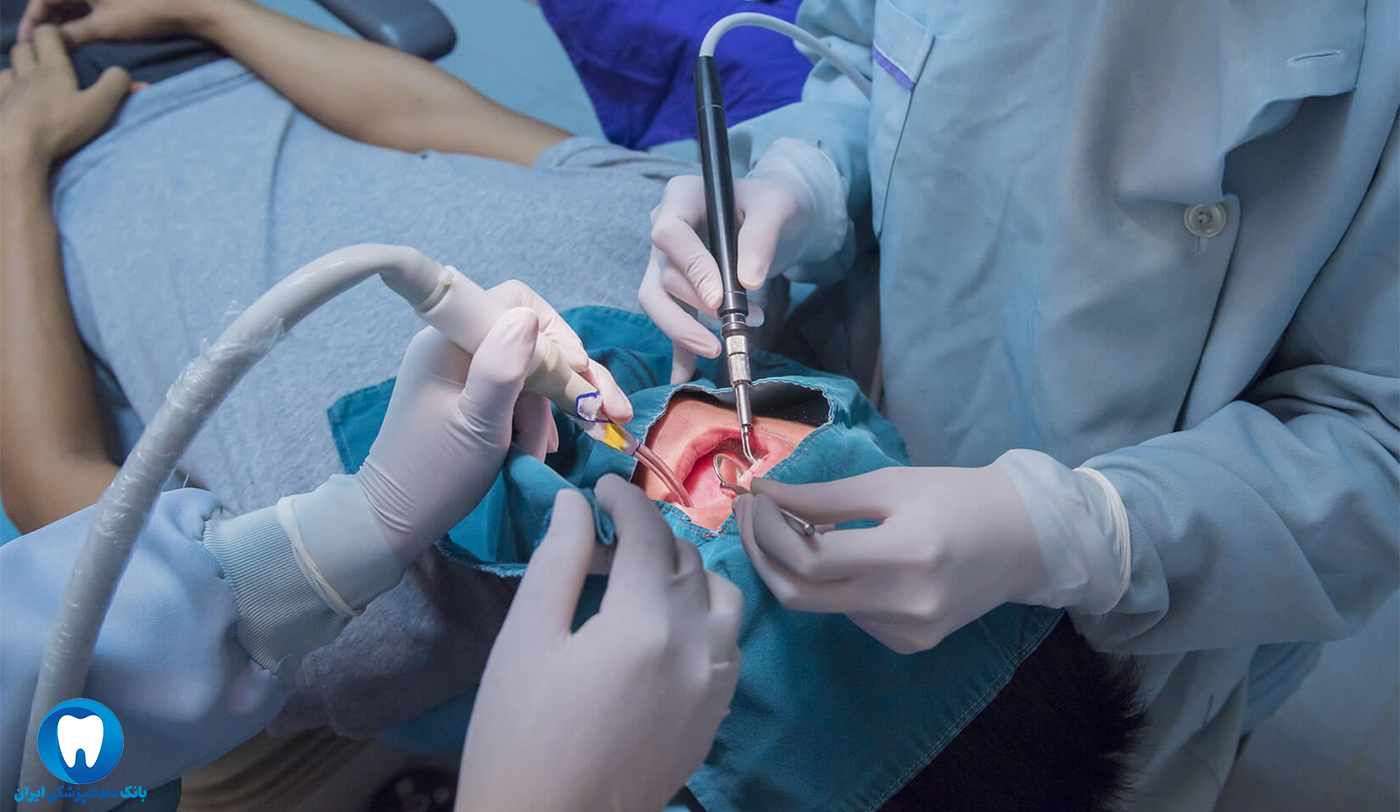 جراحی دندان برای کاشت