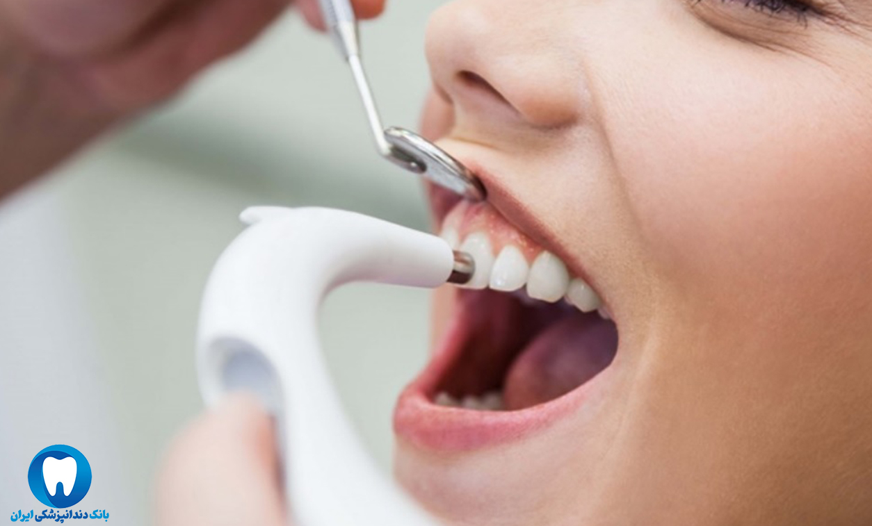 بهترین دندانپزشک کامپوزیت در مشهد