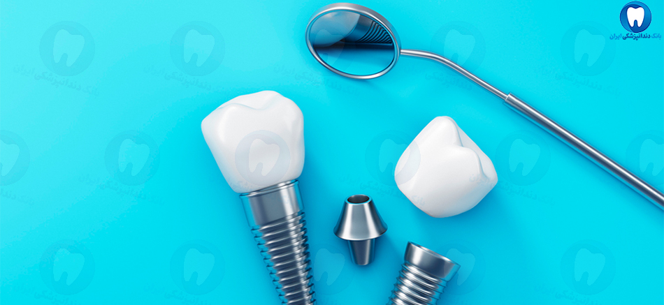بهترین دندانپزشک متخصص ایمپلنت دندان در اندیمشک