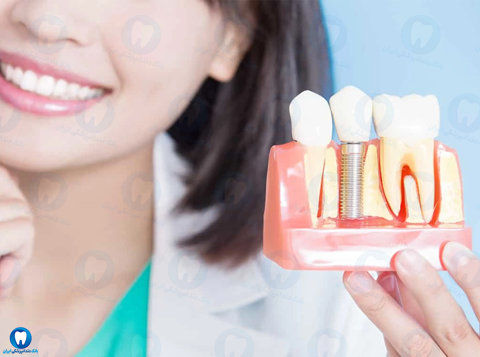 بهترین دکتر متخصص ایمپلنت دندان در کازرون