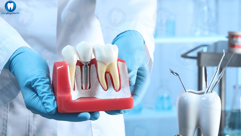بهترین دندانپزشکی ایمپلنت دندان در خوی