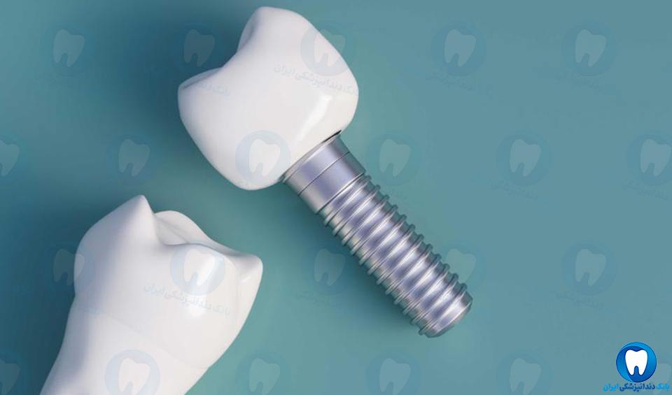 بهترین دندانپزشک متخصص ایمپلنت دندان در خرمشهر