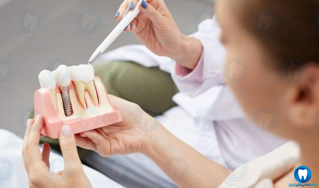 بهترین دندانپزشکی ایمپلنت دندان در مرودشت