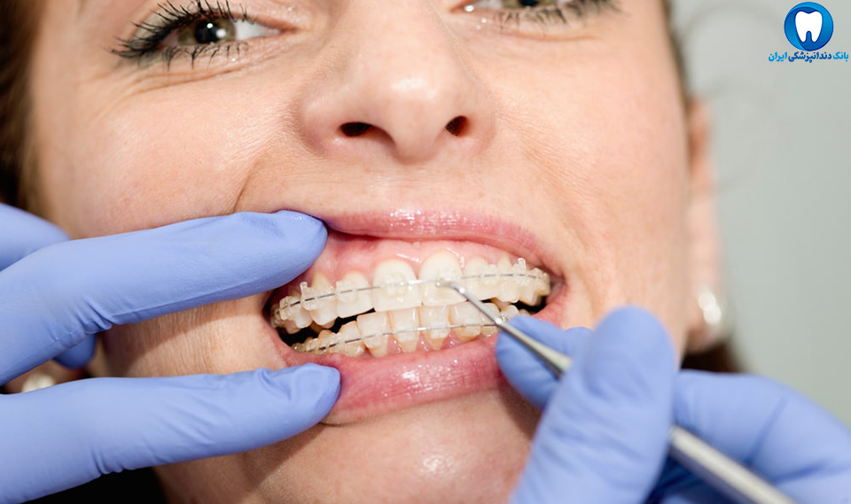 بهترین دندانپزشک ارتودنسی دندان در سبزوار