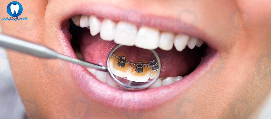 بهترین دندانپزشک ارتودنسی دندان در ساری