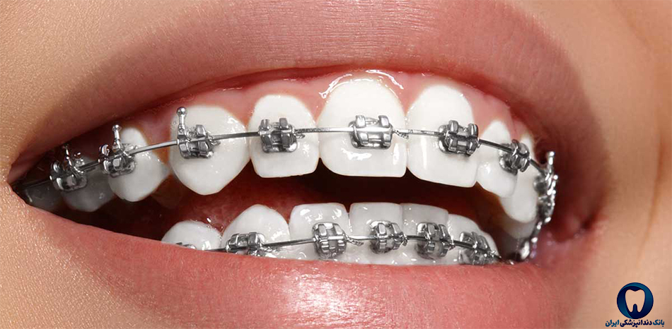 بهترین دندانپزشک ارتودنسی دندان در سمنان