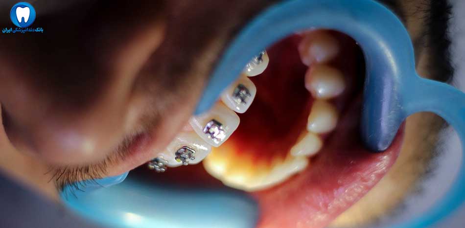 بهترین دندانپزشکی ارتودنسی در سمنان