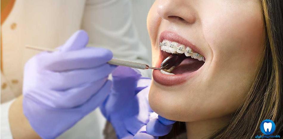 بهترین دکتر دندانپزشک ارتودنسی دندان در سمنان